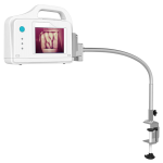 Vein Illuminator